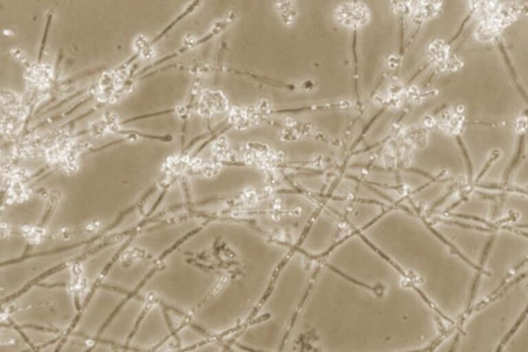 A microscopic view of Candida albicans, showing its filamentous hyphal growth form on a beige background.