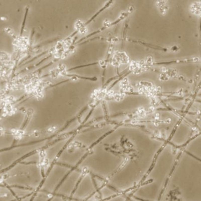 Microscopic image showing filamentous fungal hyphae and spores, stained and observed through a microscope.