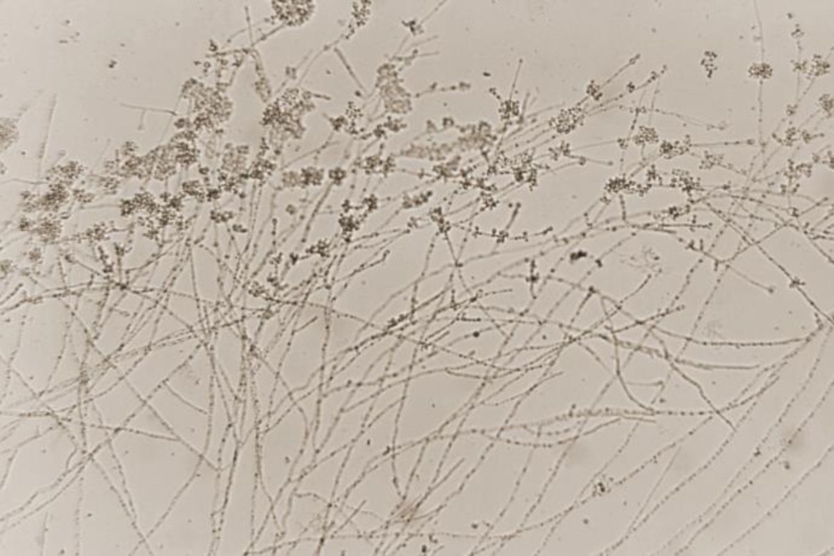 A microscopic view of thin, interwoven fungal hyphae with clusters of spores on a light background.