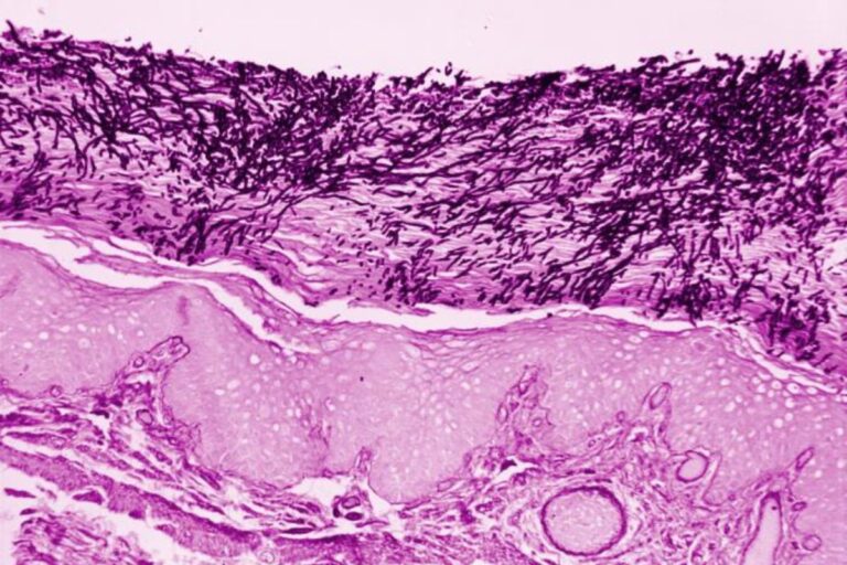 Microscopic image of human skin tissue showing multiple layers and structures, stained in shades of purple for better contrast.