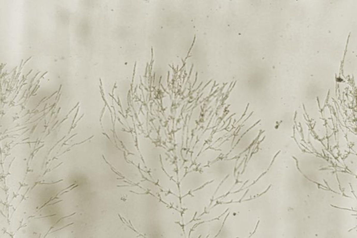 Delicate, thin branches with small buds or leaves against a light, muted background resemble the subtle complexity of nature, much like understanding what Candida albicans is—a microorganism that can cause infection when imbalanced in the body.